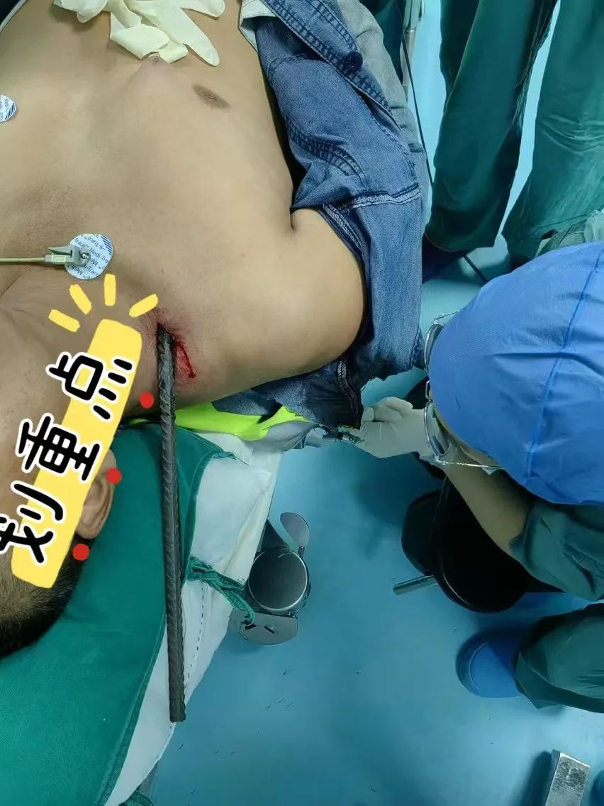 驚險(xiǎn)！中年男子被螺紋鋼筋貫穿胸頸，隆回縣人民醫(yī)院成功施救